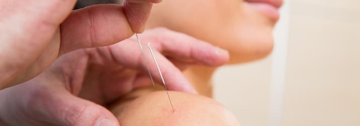 Acupuncture in Cambridge MN